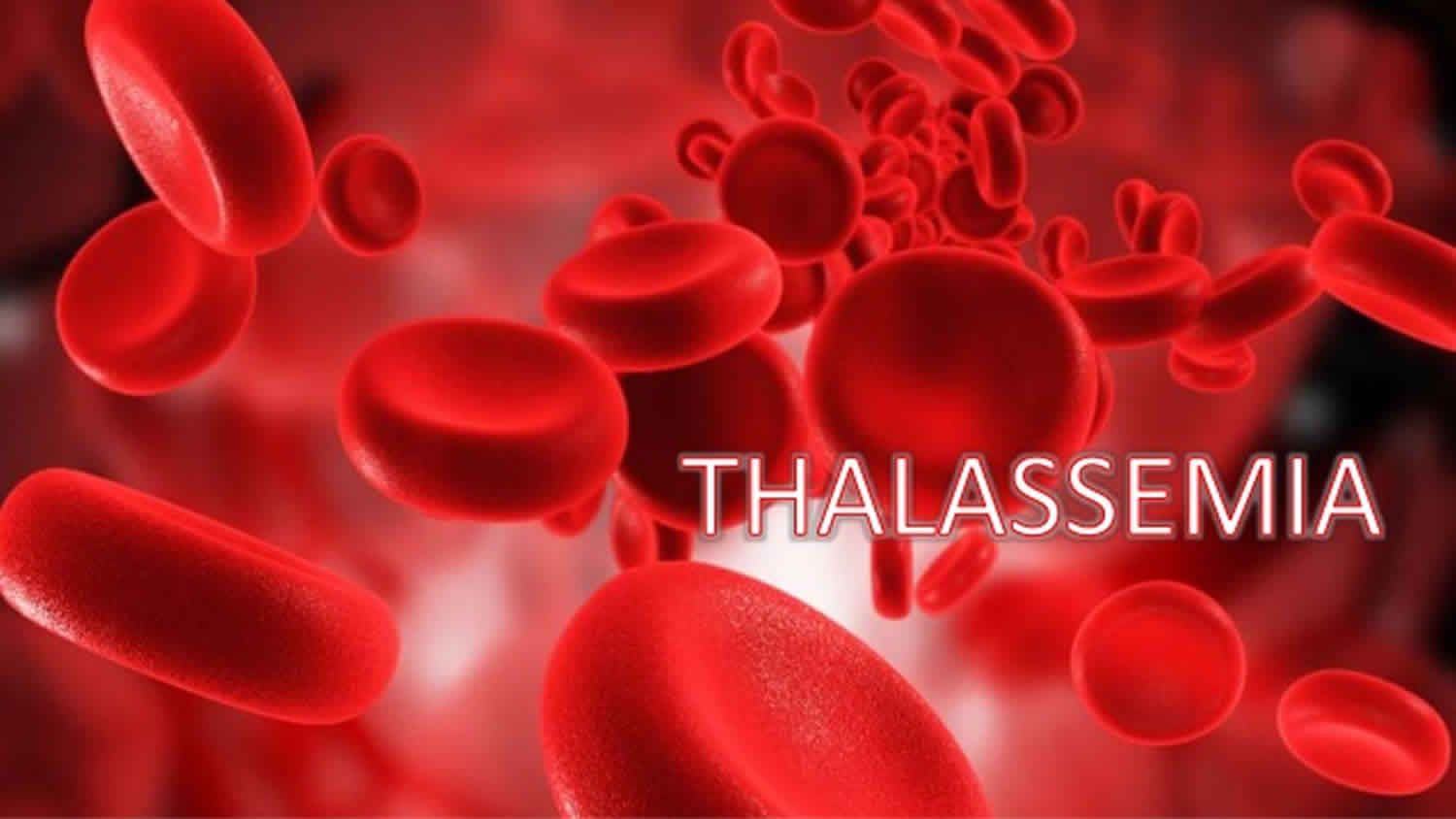 Adalah thalassemia Thalassemia